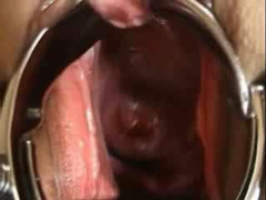 elmer wife cervix close-up