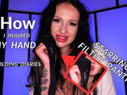 CUCKOLDING DIARIES: How I Injured My Hand